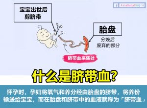 脐带血 Cord blood